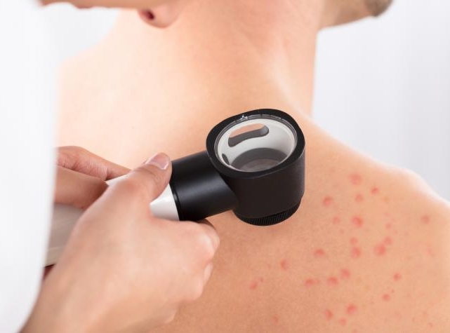 Dermatología